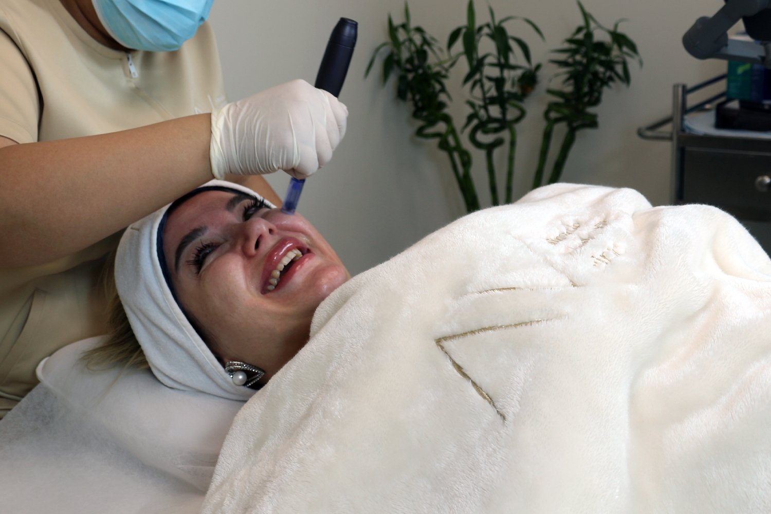 DERMAPEN TREATMENT